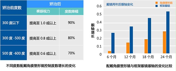 控制近视发展的理想选择