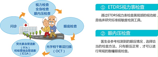 湿性老年黄斑变性专科检查