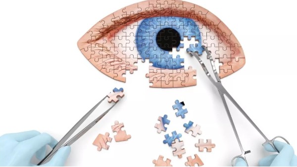 角膜塑形镜适合哪些人 衡水儿童视力矫正手术