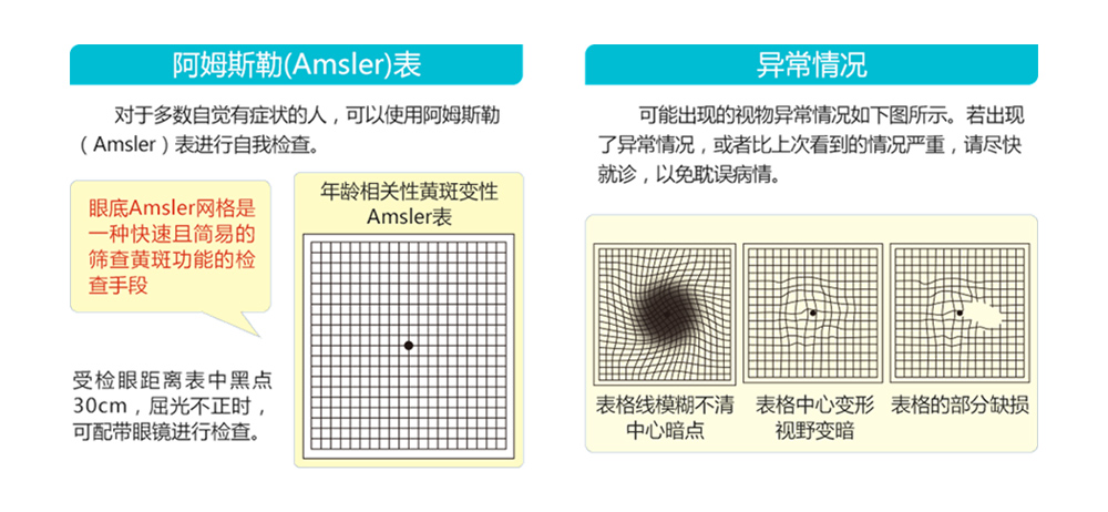 黄斑变性自我检测