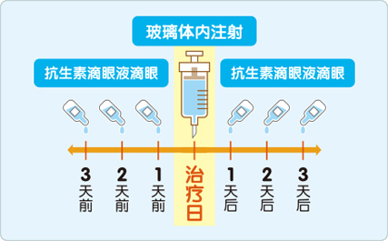 抗新生血管治疗-Lucentis雷珠单抗