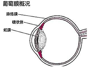 葡萄膜炎危害视力，致盲率高