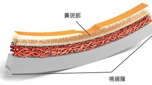 看东西变形是怎么回事 衡水黄斑病变怎么治